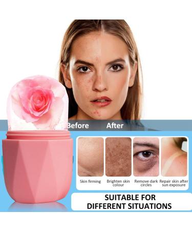 Ice Roller Ice Roller for Face and Eyes Ice Face Roller Ice Globes for Face Relief Eye Puffiness Eliminate Facial Edema Brighten Tighten Skin Remove Fine Lines Relief Sunburn(Pink) - Buy Online on SooperMarket.com