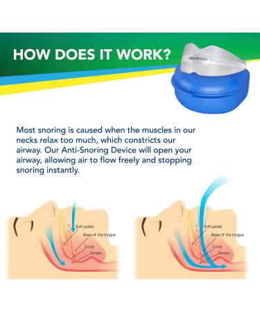 Anti Snoring Devices: Effective Snoring Solution - Snore Guard Anti-snoring Device - Snoring Mouth Guard - Anti Snore Mouthpiece for Stop Snoring (Green) - Buy Online on SooperMarket.com