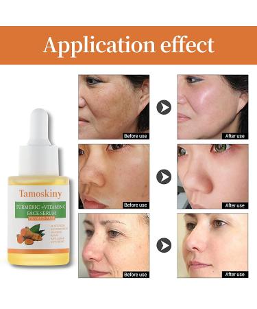 Turmeric & Vitamin C Dark Spot Corrector Serum | Anti-Aging & Moisturizing Formula for All Skin Types - 1oz - Buy Online on SooperMarket.com