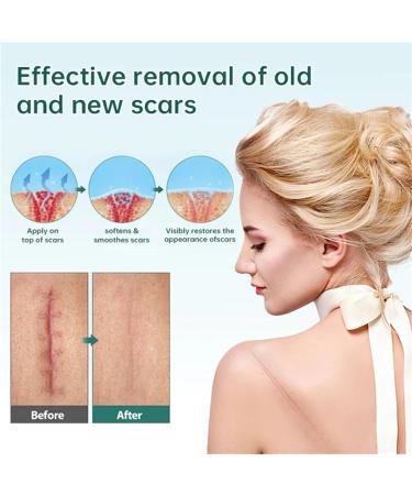 CRusio Awzlove Ampoule Scar Removal Serum - Remove New Scars in 3 Weeks, Old Scars in 6 Weeks (1pcs) - Buy Online on SooperMarket.com