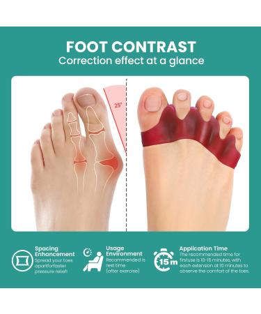Welnove 8-Pack Toe Separator to Correct Bunions and Restore Toes to Their Original Shape Bunion Corrector for Women Men Toe Spacers for Gifts (Deep Red) - Buy Online on SooperMarket.com