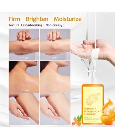 Vitamin C Cream Vitamin C Body Lotion Vitamin C Body Cream Large-capacity Body Moisturiser With Vitamin C Turmeric And Retinol Vitamin C Dry Skin Moisturiser Body Skin Care Smooth Skin 200ml - Buy Online on SooperMarket.com