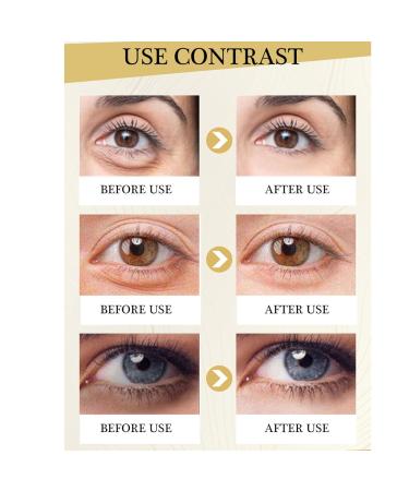 Polypeptide Eye Cream for Dark Circles & Puffiness | Anti-Aging Firming Eye Serum for Bags & Wrinkle Removal - Buy Online on SooperMarket.com