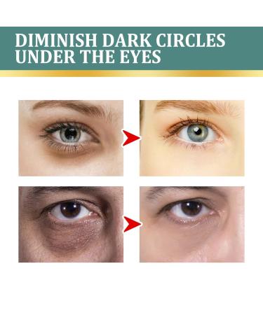 2PC Jasmine Ointment for Dark Circles - Anti-Aging Eye Cream with Collagen & Aloe Vera | Remove Puffiness & Bags - Buy Online on SooperMarket.com