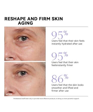 Bakuchiol Retinol Alternative Eye Cream | Dark Circles Puffiness & Fine Lines | Plant-Based Peptide Treatment - Buy Online on SooperMarket.com