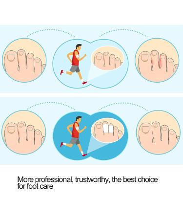 Silicone Gel Toe Separators - Hammer Toe Corrector for Men and Women - 8 Pairs - Buy Online on SooperMarket.com