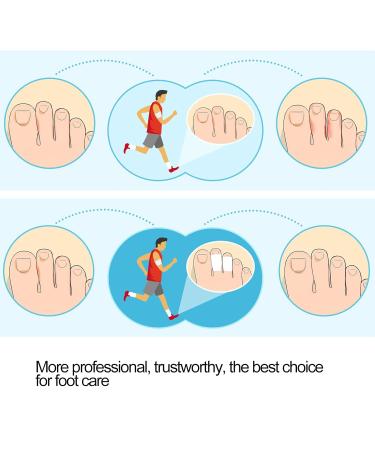 Silicone Toe Spacers - 8 Pairs for Correct Toe Alignment, Bunion & Hammertoe Straighteners | Hallux Valgus Yoga - Buy Online on SooperMarket.com
