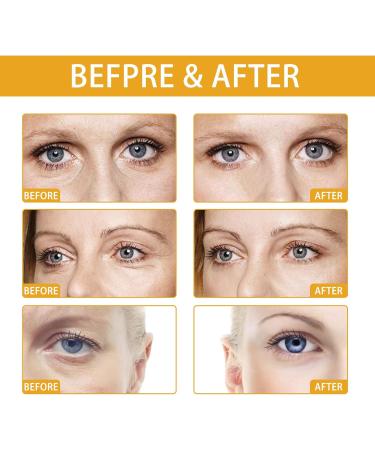 Rice Eye Cream For Dark Circles And Puffy Eyes Rice Eye Cream Anti Aging Eye Cream With Natural Rice Extract Brightens Under Eye Diminishing Deep Wrinkles Suitable For All Skin Types - Buy Online on SooperMarket.com