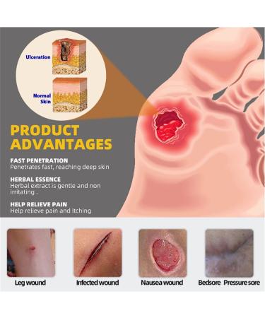KXC Decubitus Treatment Cream 20g - Relief for Pressure Sores (4 pcs) - Buy Online on SooperMarket.com
