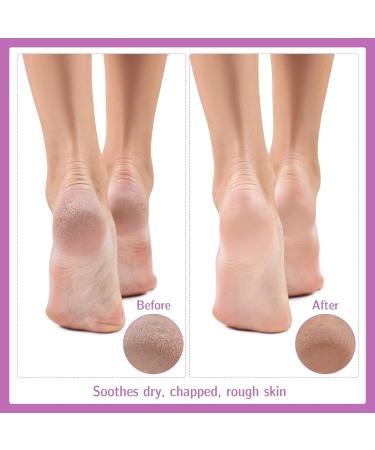 Heyu-Lotus Moisturizing Socks - 6 Pairs Overnight Foot Spa Cotton Socks for Dry Cracked Feet - Buy Online on SooperMarket.com
