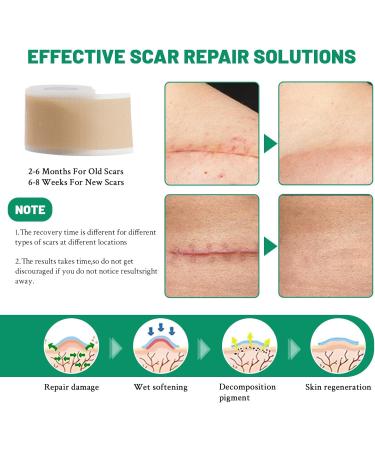 3 Rolls Silicone Scar Sheets(1.6" x 60" Each) Silicone Patches for Scars Reusable Scar Removal Strips for Prevention and Repair - Buy Online on SooperMarket.com