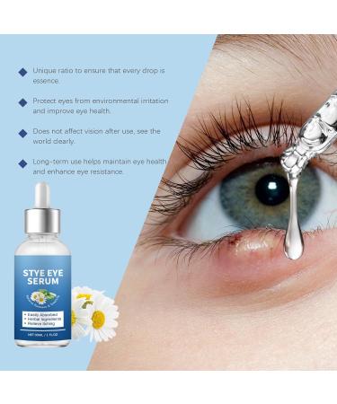 Stye Eye Treatment & Chalazion Remover | Eye Relief Serum & Gentle Lash Cleanser - Fast International Shipping - Buy Online on SooperMarket.com