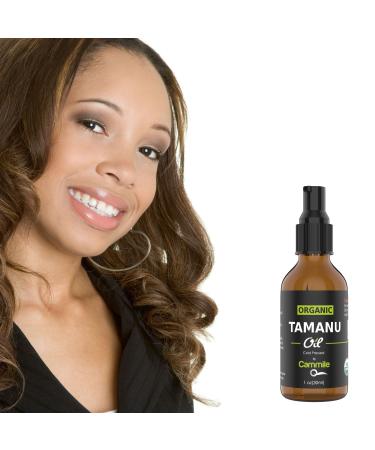 Organic Tamanu Oil - Natural Psoriasis Treatment Eczema Relief & Acne Scars - Cold Pressed & International Shipping - Buy Online on SooperMarket.com