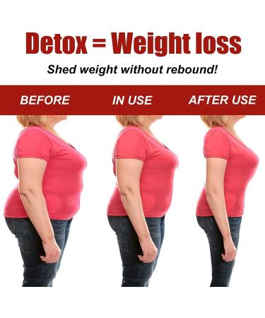 Puradee 2PCS Soothe&Slim Anti-Itch Detox Slimming Capsule - Natural Relief & Weight Loss Support - Buy Online on SooperMarket.com