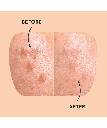 Rael Miracle Microcrystal Dark Spot Cover - Hydrocolloid Post Acne Dark Spots Skin Care - 6 Count - Buy Online on SooperMarket.com