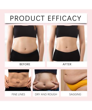 Skin Tightening Cream Body for Belly Fat Hibiscus & Honey Skin Firming Body Cream Cellulite Cream Hibiscus & Honey Body Shaping Cream Cellulite Remover Lifting Moisturizing Elasticity Natural - Buy Online on SooperMarket.com