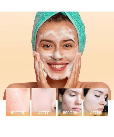 Vitamin C Hydrating Foaming Facial Cleanser - Gentle Acne-Prone Skin Wash with Silicone Brush - Vegan Daily Cleanser for Men & Women - 4.2oz - Buy Online on SooperMarket.com