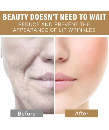 Buy Lip Lift Anti-Wrinkle Patches | Smooth Smile Lines & Fine Lines Fast - Gold Silicone Lip Mask - Buy Online on SooperMarket.com