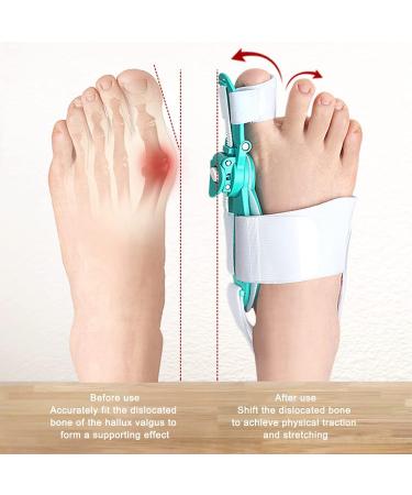 Hallux Valgus Corrector | Ergonomic Adjustable Bunion Support | Professional Orthopedic Care for Home - Buy Online on SooperMarket.com