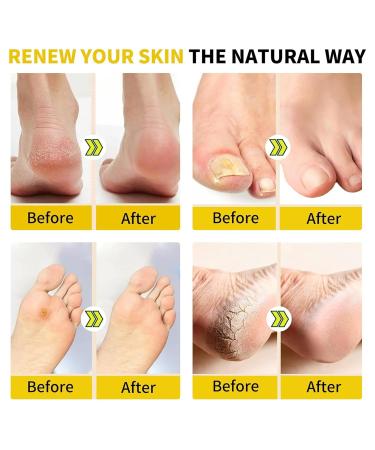 2023 Detoxing Herbs Cleansing Foot Soak Beads - Weight Loss & Foot Bath Relief - Buy Online on SooperMarket.com