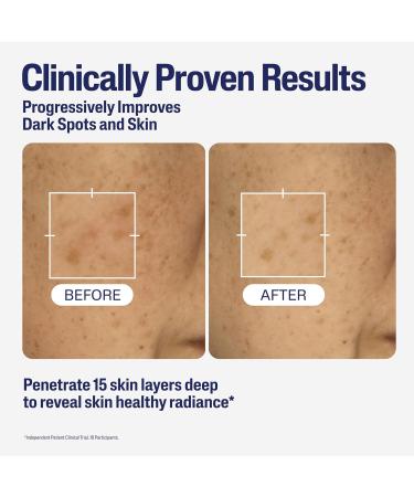Cetaphil Healthy Radiance Brightening Serum with Niacinamide for Skin Pigmentation 30ml - Buy Online on SooperMarket.com
