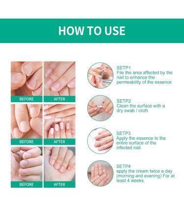 2Pack Kerassentials Toenail Oil and Skin Treatment Set for Nail Care - Buy Online on SooperMarket.com