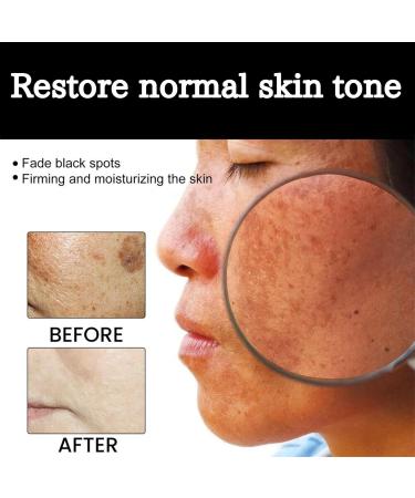 Me-lanin Correcting Cream Skin Whiten Cream Dark Spots Corrector Cream Facial Repair Cream Natural Brightening Moisturizer Cream For Body Face Neck - Buy Online on SooperMarket.com