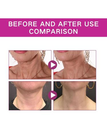 Collagen Potenting Neck Cream Neck Firming Cream Anti Age Face Cream Skin Tightening Cream for Face Anti Wrinkle Moisturizing Smoothing Neck Tightening Lifting Sagging Skin - Buy Online on SooperMarket.com