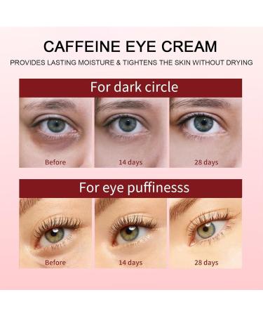 Caffeine Eye Cream for Dark Circles & Puffiness | Anti-Aging Under Eye Serum for Bags Wrinkles & Fine Lines - Visible Firming & Tightening Formula - Buy Online on SooperMarket.com