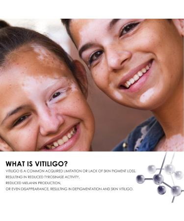 Anggrek 30ml Vitiligo Care Spray - Gentle Whitening Relief for Skin Repair - Buy Online on SooperMarket.com