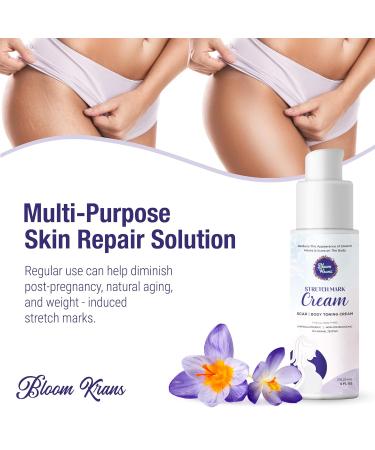 Bloom Krans Stretch Mark Cream for Pregnancy | Moisturizing Stretch Mark Remover & Prevention Lotion for Pregnant Belly & Postpartum Essentials - Buy Online on SooperMarket.com