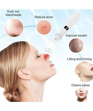 Blackhead Extractor Blackhead Remover Skin Tag Removal Kit with 5 Probes Pore Extractor Portable Pimple Extractor Rechargeable USB Port 3 Speeds Control for Women and Men White - Buy Online on SooperMarket.com