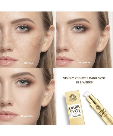 PARADREAM Dark Spot Remover Serum - Melasma & Hyperpigmentation Treatment for Face & Body (1 FL OZ) - Buy Online on SooperMarket.com