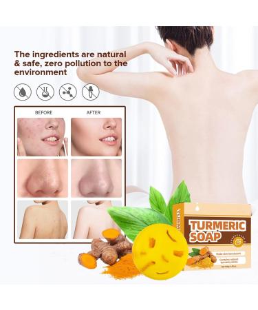 Turmeric Soap Bar for Face & Body - Moisturizing Soap for Hyperpigmentation & Dark Spots - All Skin Types - 1 Count - Buy Online on SooperMarket.com