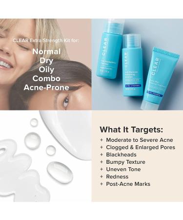 Paula's Choice CLEAR Extra Strength Acne Travel Kit - 2% Salicylic Acid & 5% Benzoyl Peroxide for Severe Acne - Redness Relief - Two Week Trial Size - Buy Online on SooperMarket.com