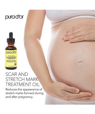 PURA DOR Organic Scar & Stretch Mark Treatment Oil | 1oz For Skin - Rosehip, Wheat Germ, Argan, Tamanu, Carrot, Rosemary, Lavender, Geranium, Patchouli, Sage - Buy Online on SooperMarket.com