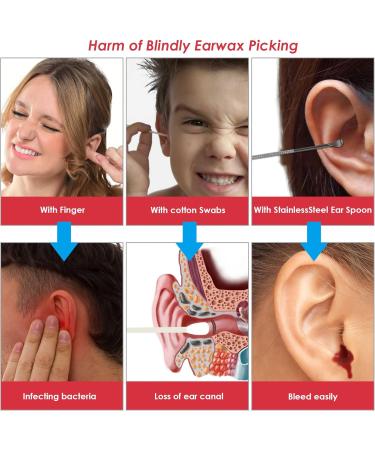 Earwax Remover Tool MYPIN 1080P HD Wireless Otoscope Ear Cleaner Kit Ear Wax Removal Kit Camera Ear Drops for Wax Ear Camera for iPhone/iPad/Android Red - Buy Online on SooperMarket.com