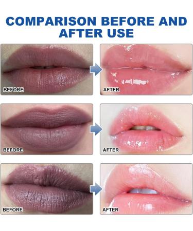 Lip Lightening For Dark Lips Aloe Vera Lip Balm Lips Pink Bleaching Cream Balm Moisturizing Lip Balm Whitening & Brightening Remove Dark Lips 3g - Buy Online on SooperMarket.com