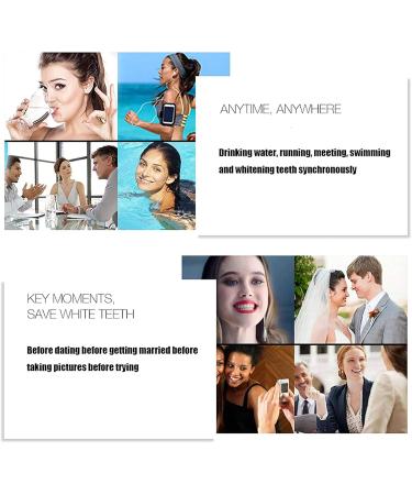 Tistics False Teeth Veneers | Temporary Dentures & Immediate Veneers | Cosmetic Tooth Solutions | Tooth Whitening for Men & Women - 2 Pairs - Buy Online on SooperMarket.com