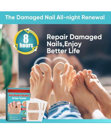 Nighttime Renewal Toe Nail Patches for Fungus - Fast & Effective Foot Care (16 Patches) - Buy Online on SooperMarket.com