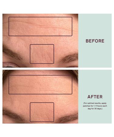 Dermaclara Silicone Face Patches for Wrinkles & Fine Lines | Anti-Wrinkle Treatment - Pregnancy Safe Skincare | Reusable Under Eye, Forehead & Face Wrinkle Patches - Buy Online on SooperMarket.com