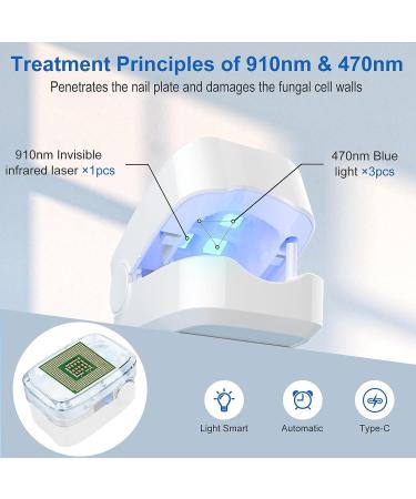 Nail Fungus Laser Treatment Device - Home Use Onychomycosis & Fungus Cleaning Treatment for Fingernails & Toenails - 910nm Infrared & 470nm Blue Light - Buy Online on SooperMarket.com