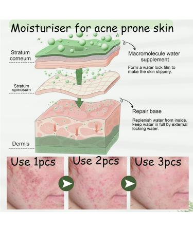 Acne Cream Moisturiser Face Cream Spot Cream Mens Moisturiser Tea Tree Cream Spot Cream For Acne Cream Moisturiser for Women Men Teenagers Dilute Face Prone Spot Marks Balance Facial Oil Cream - Buy Online on SooperMarket.com