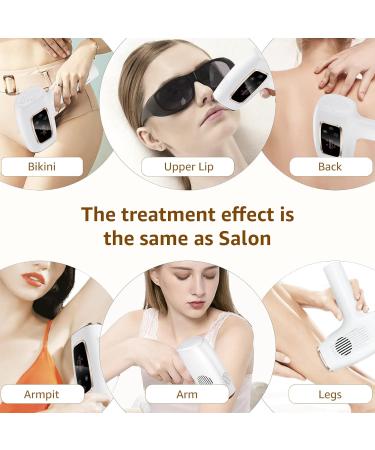 Rodzon IPL Laser Hair Removal Device - Painless Hair Remover for Women | Facial Armpits Legs Arms Bikini Line (Purple & White - Buy Online on SooperMarket.com