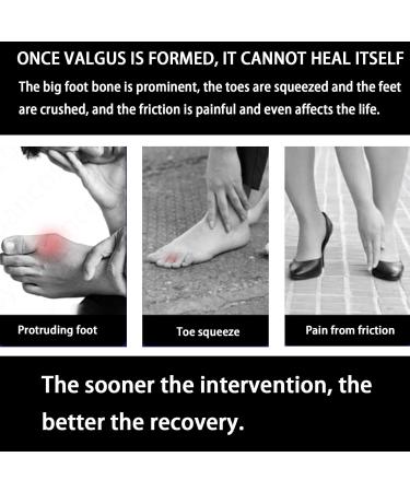 Orthopedic Toe Bunion Corrector Set Adjustable Day/Night Support for Pain Relief and Toe Alignment - Buy Online on SooperMarket.com