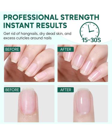 Cuticle Remover 8.45 FL OZ - Instant Softener & Salon Quality Care with Rosemary Scent - Professional Nail Care Gift for Women - Buy Online on SooperMarket.com