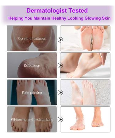 5 Pairs Foot Peel Mask lavender Foot Exfoliating Mask Socks Calluses Remover Dead Skin Moisturizing Feet Peeling Mask for Dry Skin Cracked Heels Foot SPA Socks for Women and Men (Lavender) - Buy Online on SooperMarket.com
