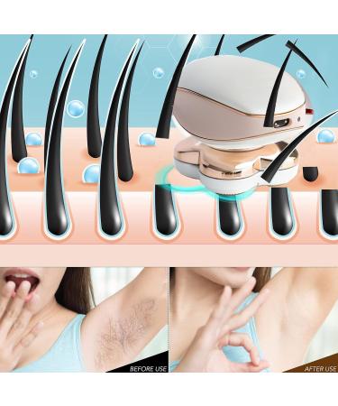 Yinuoday Cordless Electric Women's Hair Remover Painless Razor for Legs Body & Face - Buy Online on SooperMarket.com
