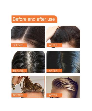 Buy Travel Size Dry Shampoo Powder - Non-Aerosol Volumizing for Men & Women | No White Cast Fuller Hair Boost | 0.3 Oz - Buy Online on SooperMarket.com