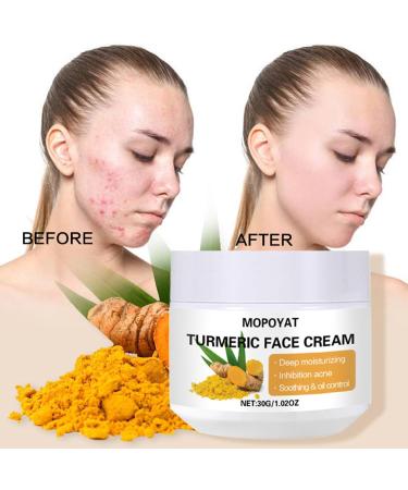 Turmeric Face Cream Face Moisturiser Anti Aging Cream for Radiant & Glowing Skin Dark Spot Corrector Remover for Face Natural Turmeric Cream Skin Care Moisturizing Erase Fine Lines Firming - Buy Online on SooperMarket.com